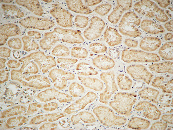 IGF-IR Polyclonal Antibody
