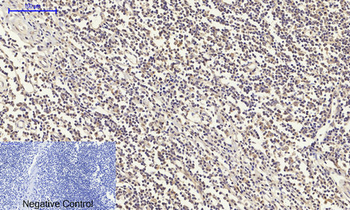 IGF-IR Polyclonal Antibody