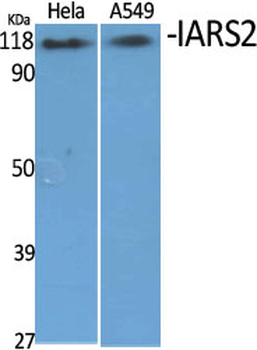 IARS2 Polyclonal Antibody