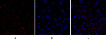 HSP27 Polyclonal Antibody