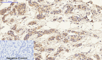 HSP27 Polyclonal Antibody