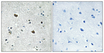 HSP70 Polyclonal Antibody
