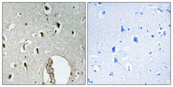 HLX1 Polyclonal Antibody
