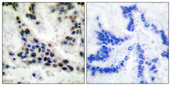 Histone deacetylase 1 Polyclonal Antibody