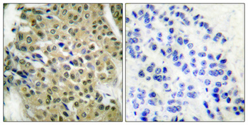 HDAC5/9 Polyclonal Antibody