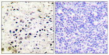 HDAC5/9 Polyclonal Antibody