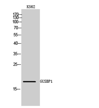 GUSBP1 Polyclonal Antibody