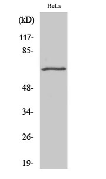 GRK 5 Polyclonal Antibody