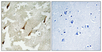 GRIN2 Polyclonal Antibody