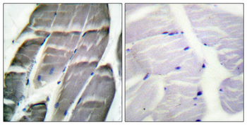 Glycogen Synthase 1 Polyclonal Antibody