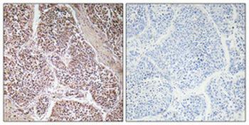 GDF-9 Polyclonal Antibody