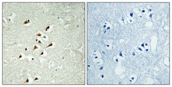 GCP5 Polyclonal Antibody