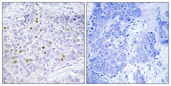 GCN5 Polyclonal Antibody