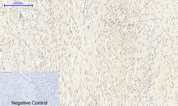 FoxO1 Polyclonal Antibody