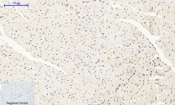 FoxO1 Polyclonal Antibody