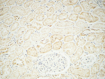 Fhit Polyclonal Antibody