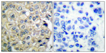 FGFR-3 Polyclonal Antibody