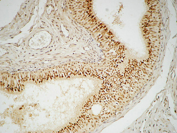FEN-1 Polyclonal Antibody