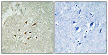 FBP3 Polyclonal Antibody