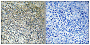 FASTKD3 Polyclonal Antibody