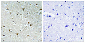 FAM111B Polyclonal Antibody
