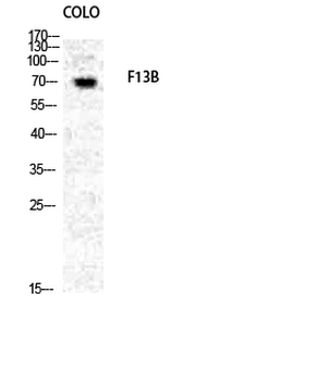 Factor XIII B Polyclonal Antibody