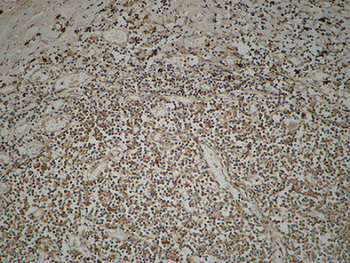 ETS1 Polyclonal Antibody