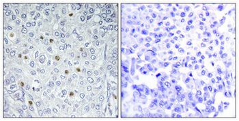 ERK 3 Polyclonal Antibody