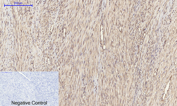 ERK 1/2 Polyclonal Antibody