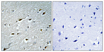 HAND1 Polyclonal Antibody