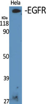 EGFR Polyclonal Antibody