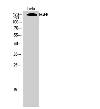 EGFR Polyclonal Antibody