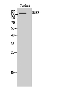 EGFR Polyclonal Antibody