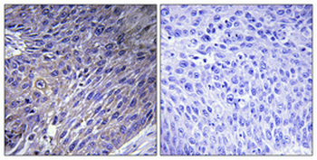 EF-G2 Polyclonal Antibody