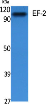 EF-2 Polyclonal Antibody