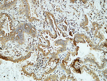 E-cadherin Polyclonal Antibody