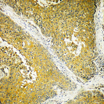 Dynein LC 2 Polyclonal Antibody