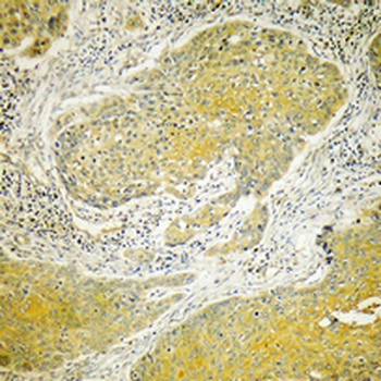 Dynein LC 2 Polyclonal Antibody