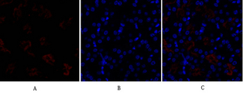 DRP1 Polyclonal Antibody