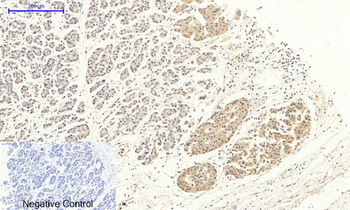 DRP1 Polyclonal Antibody