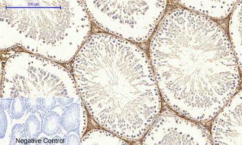 DRP1 Polyclonal Antibody