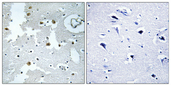 DJ-1 Polyclonal Antibody