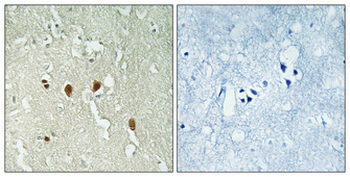 DJ-1 Polyclonal Antibody
