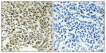 DDX55 Polyclonal Antibody