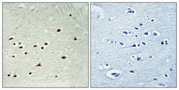 DDX51 Polyclonal Antibody