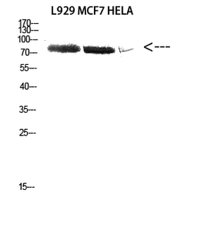 DDX3 Polyclonal Antibody