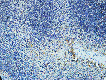 DAPK2 Polyclonal Antibody