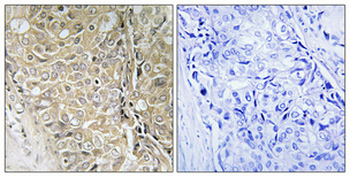 D55 Polyclonal Antibody