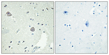 D1DR Polyclonal Antibody