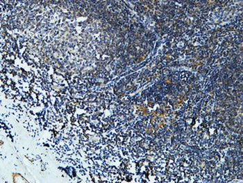 CYP19A1 Polyclonal Antibody